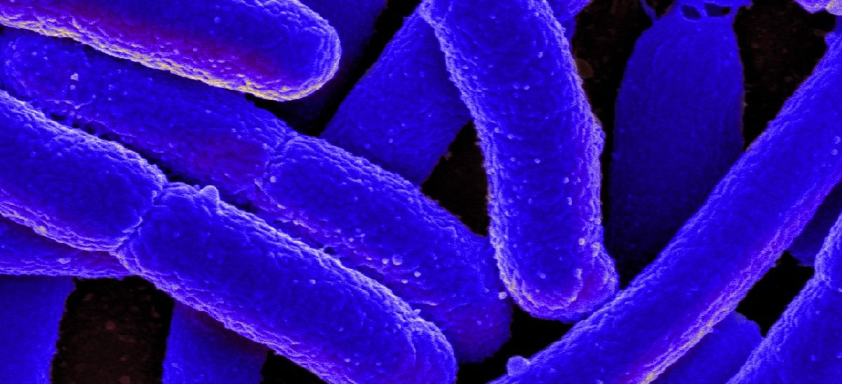 E. coli bacteria. Source: NIAID