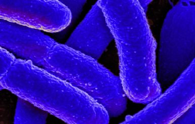 E. coli bacteria. Source: NIAID